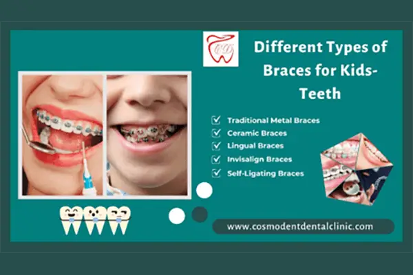 Different Types of Braces for Kids-Teeth