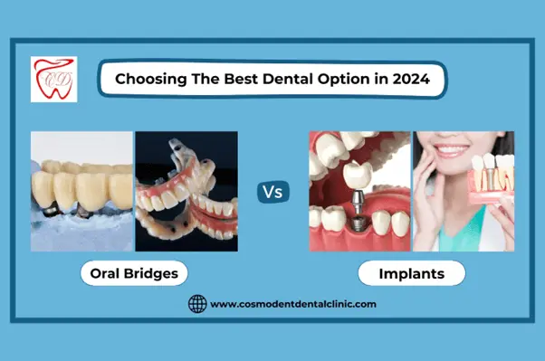 Oral Bridge vs Implant