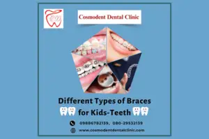 Types-of-Braces-for-Kids-Teeth-Traditional-Metal-Braces