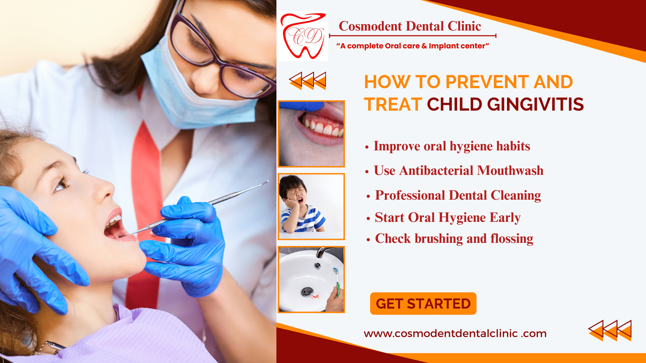 Treatment of Child Gingivitis