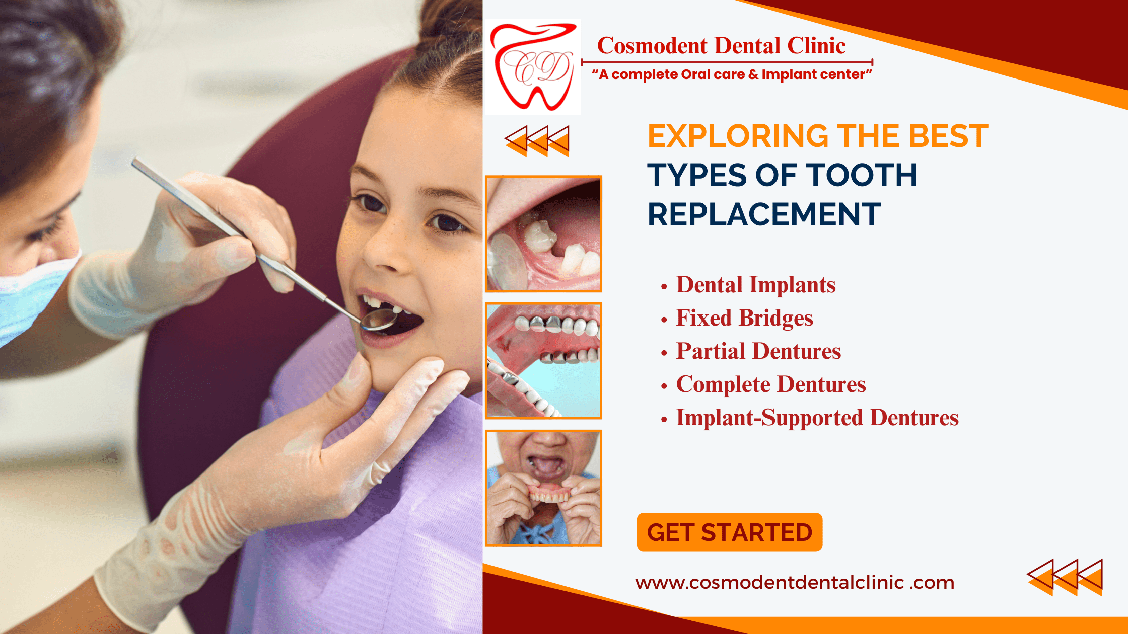 Types of Tooth Replacement