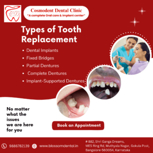 Types of Tooth Replacement