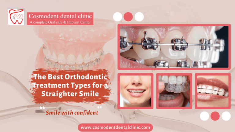 Discover the Best Orthodontic Treatment Types for a Perfect Smile