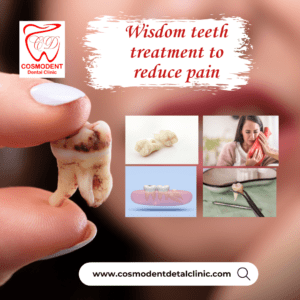 wisdom teeth treatment