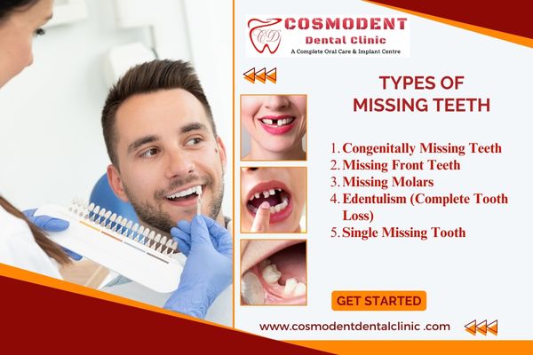 types of mission teeth