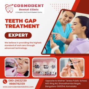 teeth gap treatment