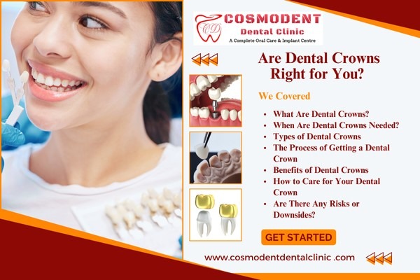 Dental crowns a complete guide
