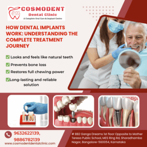 dental implants