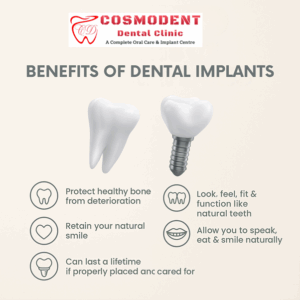 Benefits of dental implants