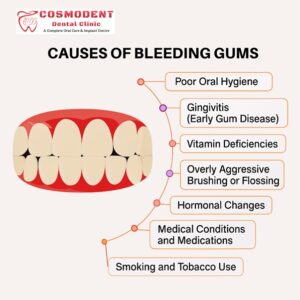  Causes of bleeding gums