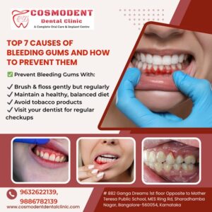 Top 7 Causes of bleeding gums