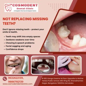 Not Replacing Missing Teeth